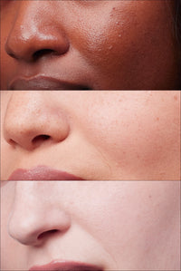 Cool skin tone